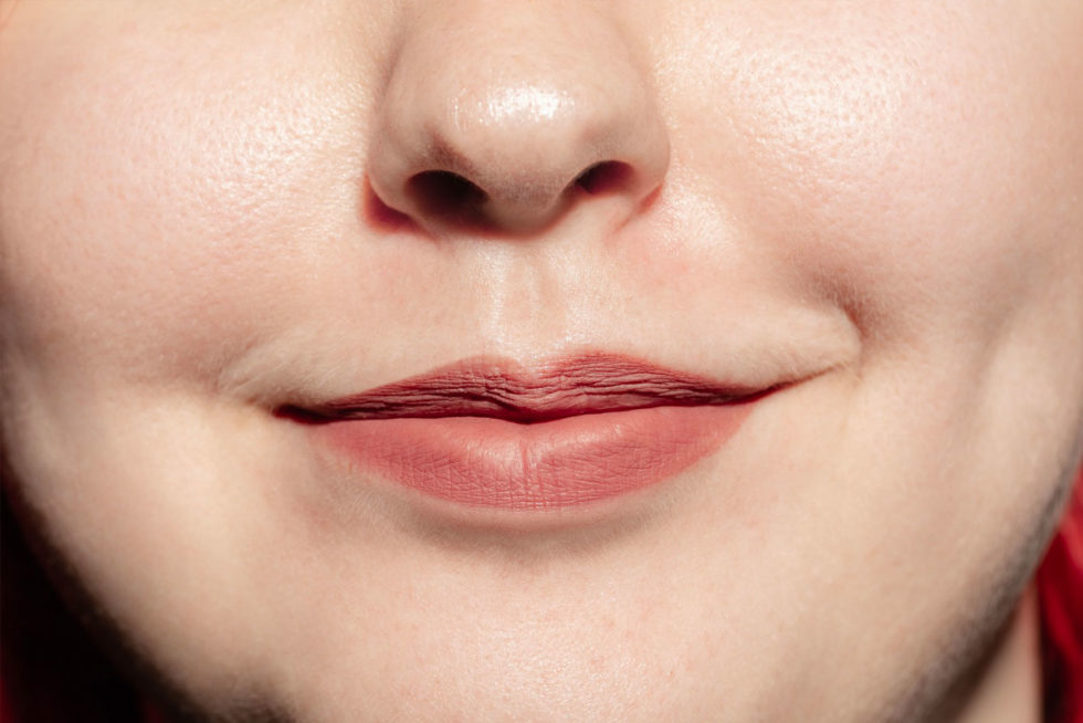 Elevate Mouth and Lip Corners Scottsdale | Botox Lip Scottsdale